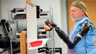Increíble: Hombre logra mover sus brazos robóticos con la mente