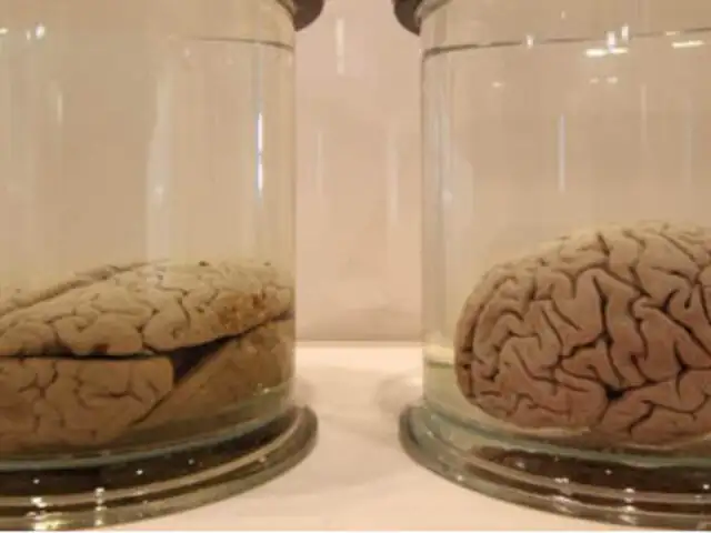Roban 100 cerebros conservados en el sótano de una universidad estadounidense
