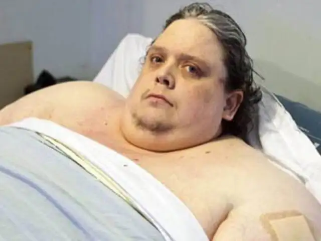 FOTOS: falleció Keith Martin, el hombre más gordo del mundo