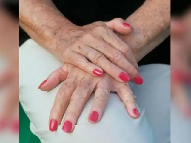 Canadá: descubren el secreto para detener el envejecimiento de la piel