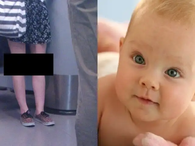 FOTOS: mira la curiosa rodilla de una mujer que tiene ‘cara de bebé’