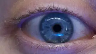 Desarrollan tratamiento láser que es capaz de cambiar el color de los ojos