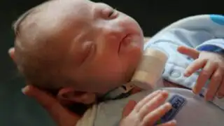 Insólito: nace un bebé sin nariz  en los  Estados Unidos