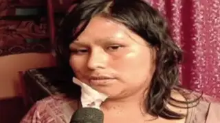 Dan de alta a mujer agredida brutalmente por su expareja en SMP