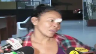 Miraflores: 'Mujer boa' denunció a su pareja por presunto secuestro y violación