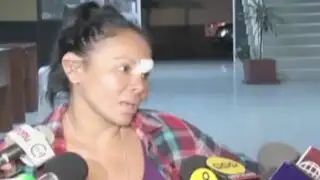 Miraflores: ‘mujer boa’ denuncia haber sido agredida por su pareja