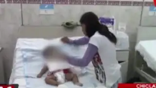 Chiclayo: amputan brazo a bebé por mordedura de serpiente