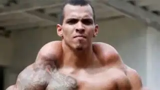 VIDEO: brasileño se inyecta aceite y alcohol en los bíceps para aumentar músculos
