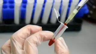 España: probarán nueva vacuna contra el sida en 200 personas en 2016