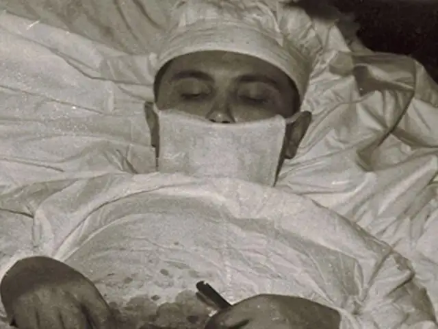 Leonid Rógozov, el médico que se operó a sí mismo