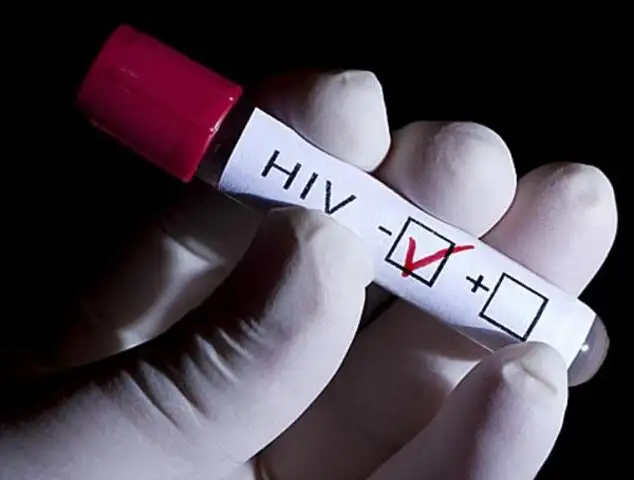 Este país latinoamericano es el primero en eliminar transmisión de VIH de madre a hijo