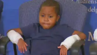 Conoce a Zion Harvey, el primer niño del mundo que recibe un trasplante de manos