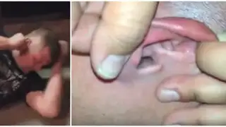 YouTube: le ayudaron a limpiar la oreja y lo que hallaron los dejó en shock