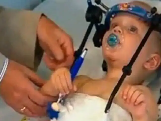 FOTOS: logran unir cabeza de niño decapitado y le salvan la vida
