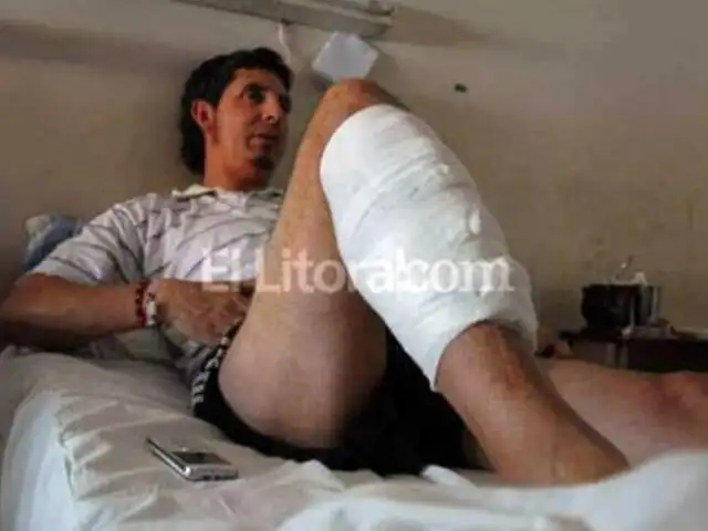 Casi le cortan la pierna: médico olvida guante durante operación