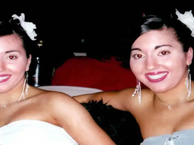 FOTOS: hermanas gemelas gastan 190 mil dólares en cirugías para parecerse más