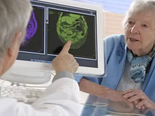 Alzheimer: lo que debes saber sobre el transtorno que ataca la memoria