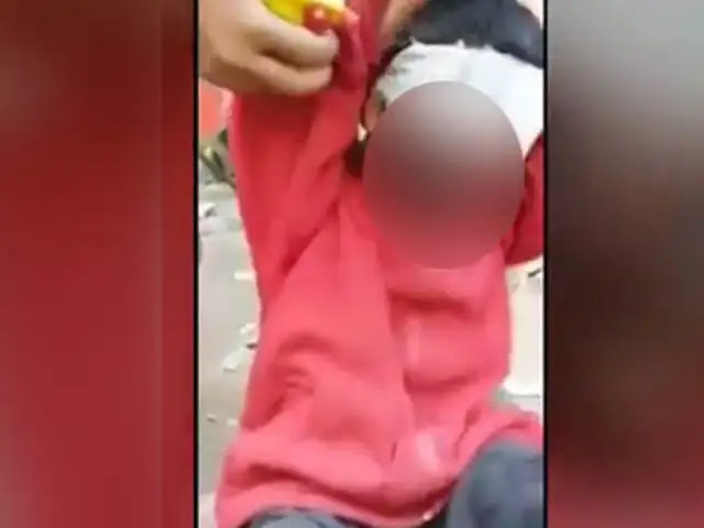 VIDEO: niño fingía estar quemado para pedir dinero