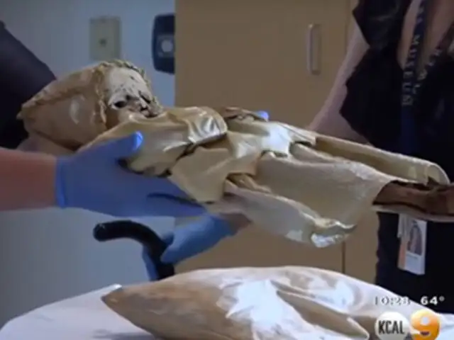 FOTOS: este bebé murió hace 300 años y ahora los médicos intentan descubrir el porqué