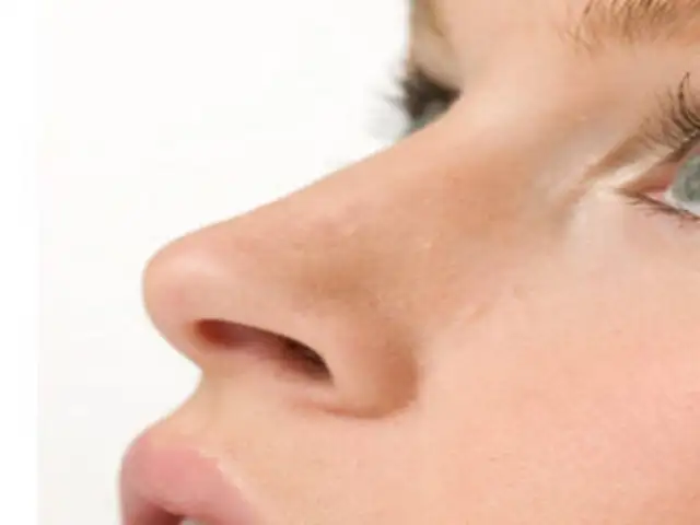 Doctor en Familia: ¿Cuáles son los problemas nasales más comunes?
