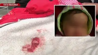 Bebé de un año resultó herida durante balacera en el Callao