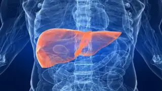 Doctor en Familia: ¿Qué es el hígado graso y cómo se puede prevenir?