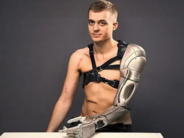 Así es el impresionante brazo biónico que busca mejorar la vida de muchas personas
