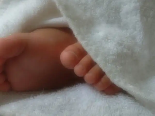 FOTOS: bebé se recupera milagrosamente tras sufrir graves lesiones