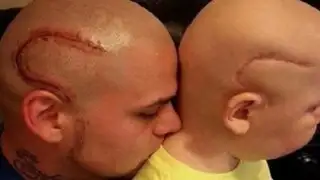 Padre se tatúa cicatriz en la cabeza para apoyar a su hijo con cáncer