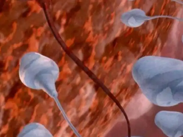 Espermatozoides artificiales: ¿el fin de la infertilidad masculina?