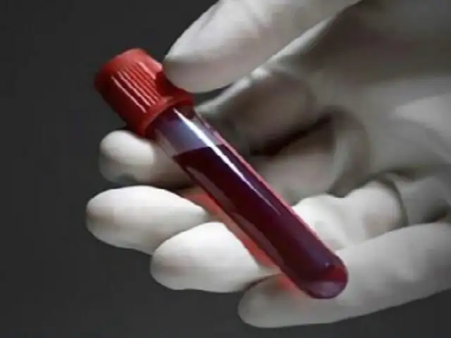 Gran Bretaña: crean prueba de sangre que predice ataque cardíaco