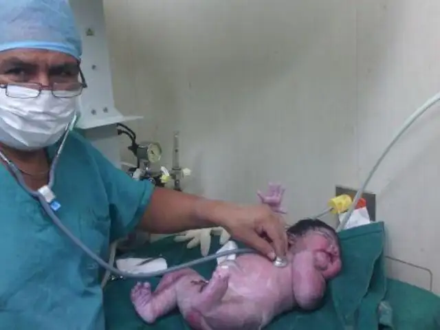 Ica: nace ‘superbebé’ de más de 6 kilos en hospital de Essalud