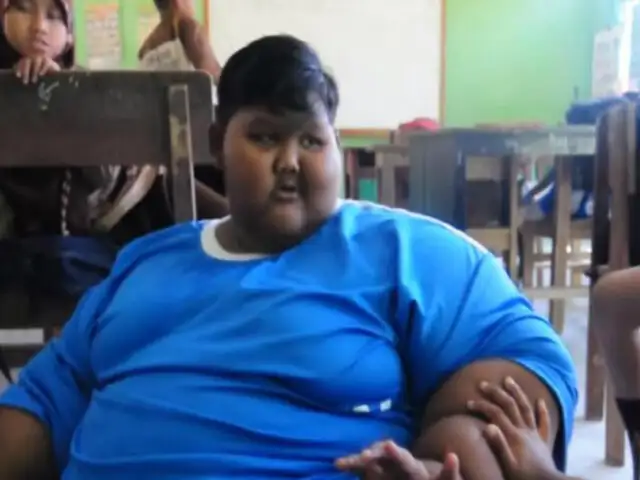 Indonesia: niño más obeso del mundo vuelve a caminar