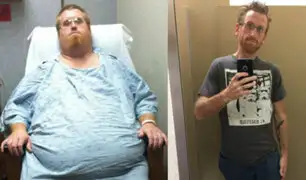 EEUU: hombre logra perder 133 kilos en año y medio de tratamiento