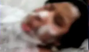 Comas: mujer embarazada fue quemada por su pareja