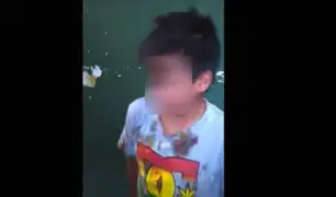 Huánuco: niño fue golpeado brutalmente por dueño de chifa