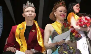 Un concurso de belleza sólo para albinos en Africa