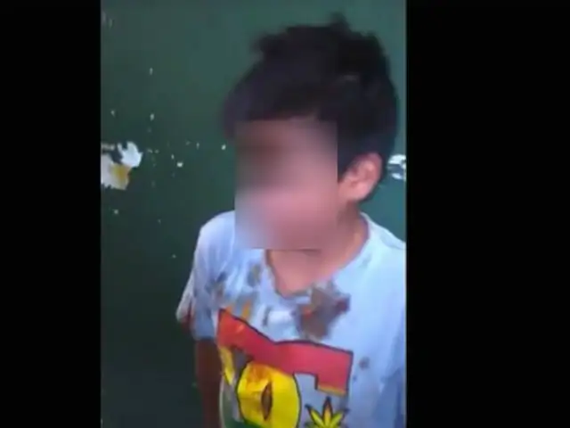 Huánuco: niño fue golpeado brutalmente por dueño de chifa