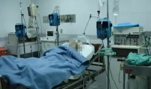 Médicos extraen por la boca de un paciente una solitaria de casi dos metros