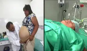 Mujer será operada por hernia gigante en Hospital de la Solidaridad de San Borja