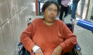Arequipa: hombre celoso ataca a su esposa con un taladro y luego fuga