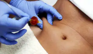 [VIDEO] Dele vitalidad a su piel con la carboxiterapia