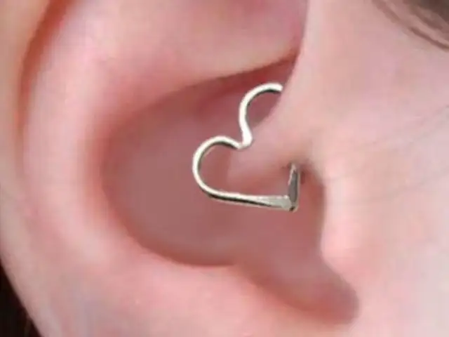 [VIDEO] Piercings terapéuticos podrían ayudar a combatir la migraña