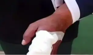 Puente Piedra: policía pierde parte de su dedo tras ser mordido por sujeto