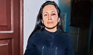 Mujer acusa a coronel de la FAP de golpearla brutalmente en Miraflores
