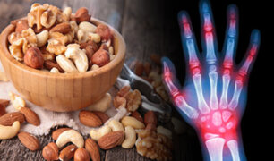 Sepa que alimentos son buenos para combatir la artritis
