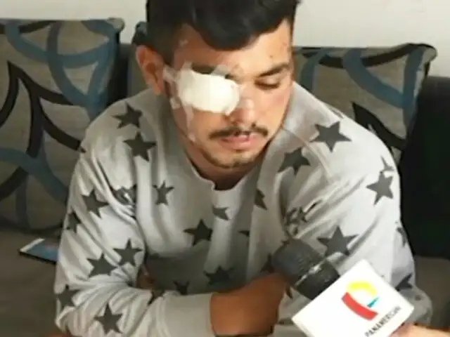 Santa Anita: joven venezolano queda desfigurado tras brutal ataque