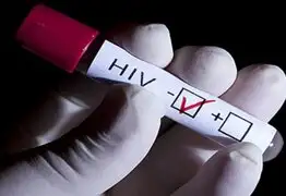 Trasplante de células madre podrían conducir a la erradicación del VIH en el cuerpo