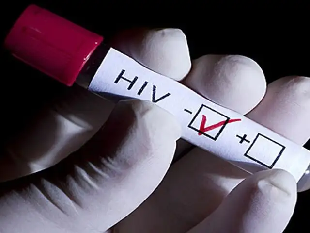 Trasplante de células madre podrían conducir a la erradicación del VIH en el cuerpo