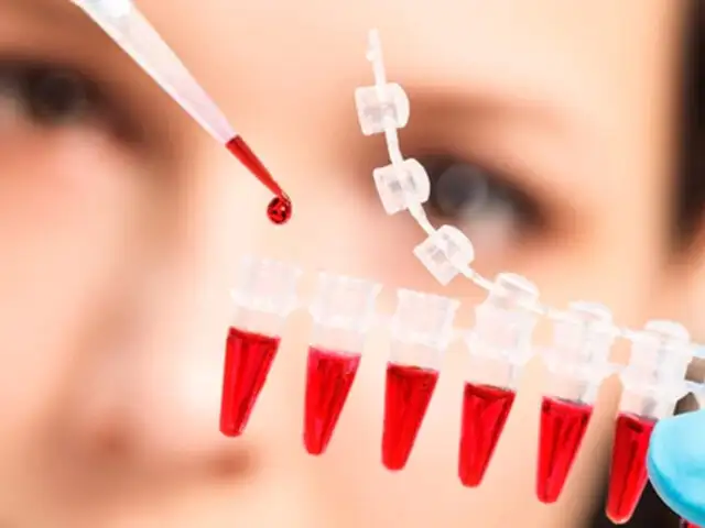 Biopsia Liquida: el examen para detectar el cáncer a tiempo